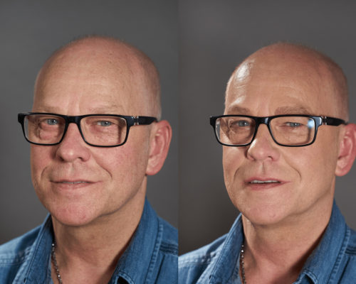 Bild vorher- nachher eins Männergesichtes Lippenkontur und Augenbrauen